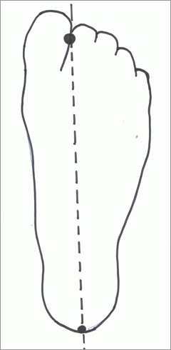 Frame-foot alignment